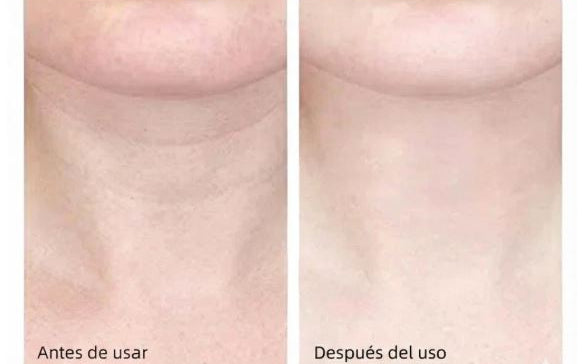 Mireal Essence – NeckLift Pro™ Masajeador Facial y de Cuello Anti-Edad.