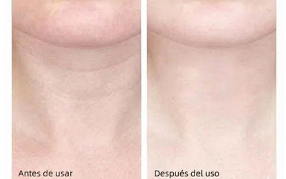 Mireal Essence – NeckLift Pro™ Masajeador Facial y de Cuello Anti-Edad.